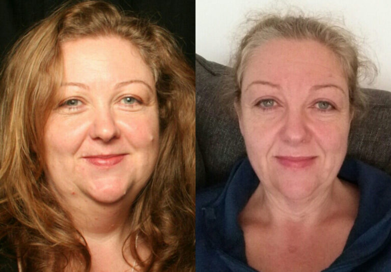 North Shore Personal Fitness And Weight Loss Coach